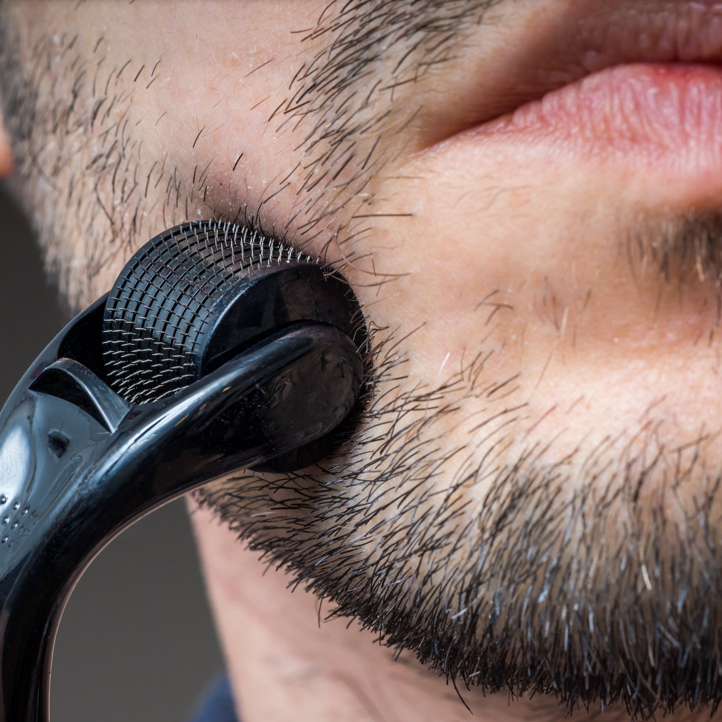 Derma Roller | For Skin & Hair