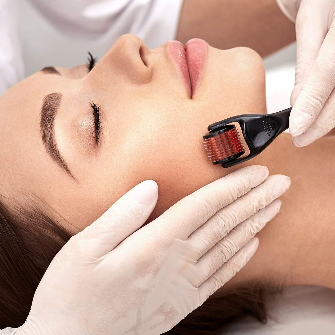 Derma Roller | For Skin & Hair